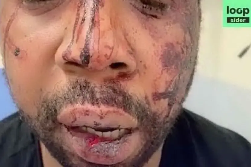 La vittima picchiata dai poliziotti (foto Instagram Mbappè)