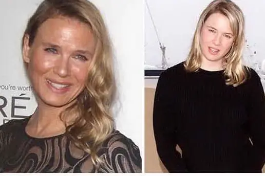 Renée Zellweger come è ora (a sinistra) e come era prima (a destra)